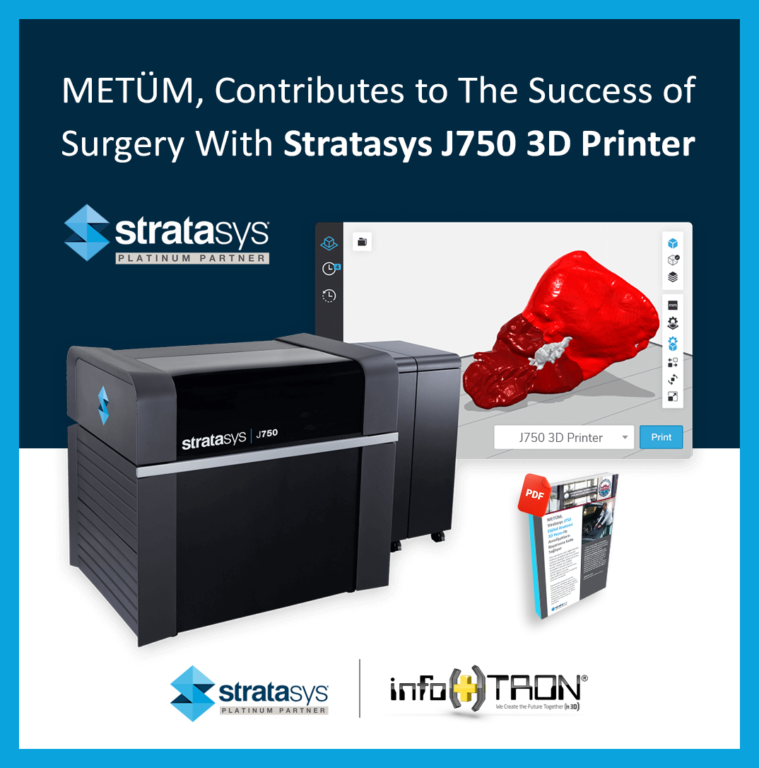 METÜM, Contributes to The Success of Surgery With Stratasys J750 3D Printer