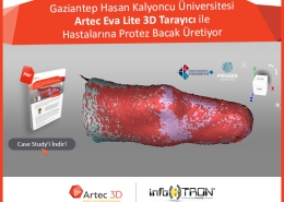 Gaziantep Hasan Kalyoncu Üniversitesi Artec Eva Lite 3D Tarayıcı ile Hastalarına Protez Bacak Üretiyor