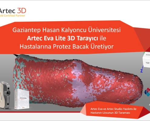 Gaziantep Hasan Kalyoncu Üniversitesi Artec Eva Lite 3D Tarayıcı İle Hastalarına Protez Bacak Üretiyor