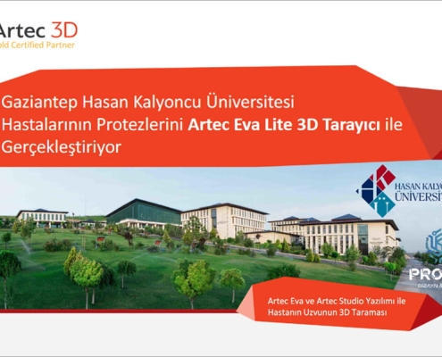 Gaziantep Hasan Kalyoncu Üniversitesi Hastalarının Protezlerini Artec Eva Lite 3D Tarayıcı İle Gerçekleştiriyor