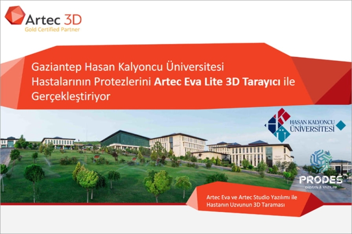 Gaziantep Hasan Kalyoncu Üniversitesi Hastalarının Protezlerini Artec Eva Lite 3D Tarayıcı İle Gerçekleştiriyor